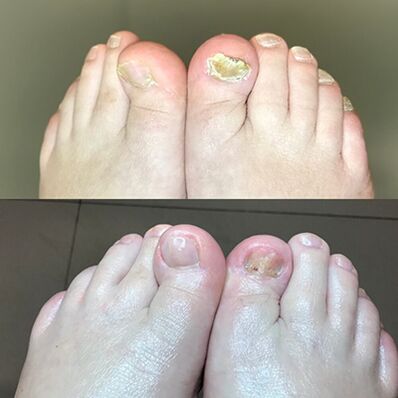 Izkušnje pri uporabi promicil kremne Barnabe iz Izraela, fotografija pred in po njem