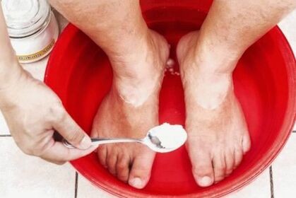 Zdravljenje glive na palcu noge