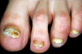 Karakterizacija bolezni