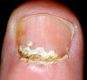 Simptomi in znaki bolezni