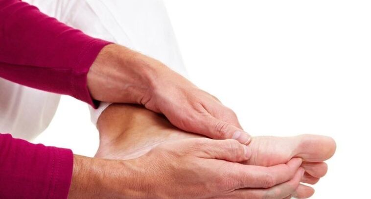 Domače zdravljenje glivic je sprejemljivo v začetni fazi